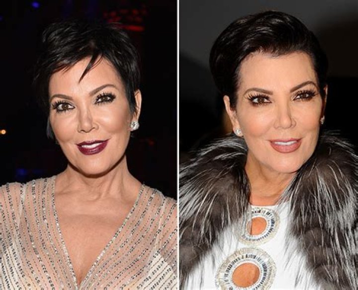 [PICS] Kris Jenner Plastic Surgery — Did Kris Get Fillers? – Hollywood Life